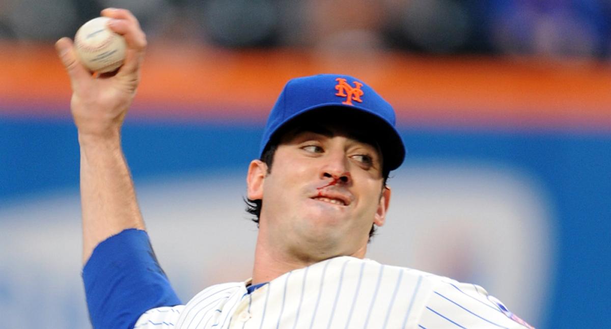 1645062373 Matt Harvey his blood in the nose and the scandal